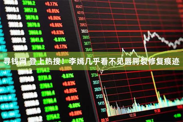 寻钱网 登上热搜！李嫣几乎看不见唇腭裂修复痕迹